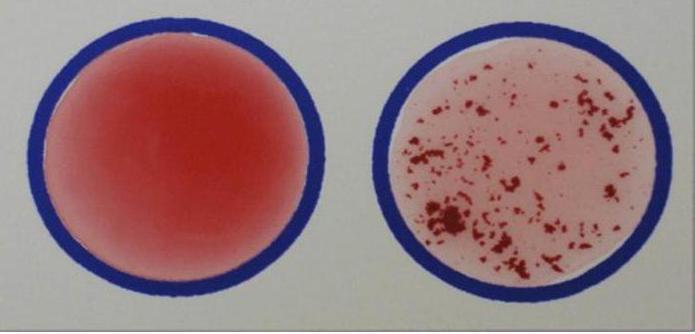 Groupes sanguins: schéma de transfusion sanguine, facteur Rh